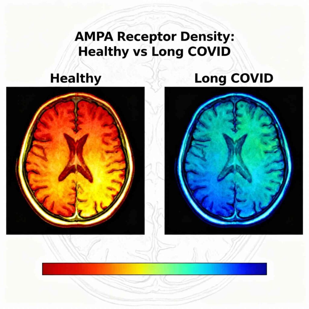 long covid brain fog